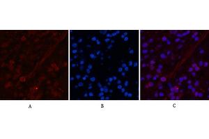 Immunofluorescence analysis of human appendix tissue. (Peroxiredoxin 1 antibody)