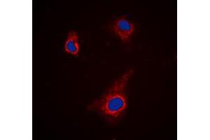 Immunofluorescent analysis of ATG4C staining in K562 cells. (ATG4C antibody  (N-Term))