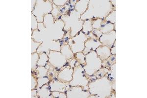 (ABIN657832 and ABIN2846797) staining Mouse Csf1r in mouse lung tissue sections by Immunohistochemistry (IHC-P - paraformaldehyde-fixed, paraffin-embedded sections). (CSF1R antibody  (C-Term))
