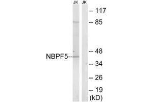 Western blot analysis of extracts from Jurkat cells, using NBPF5 antibody. (NBPF5 antibody  (C-Term))