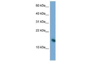 Western Blot showing PAIP2 antibody used at a concentration of 1. (PAIP2 antibody  (N-Term))