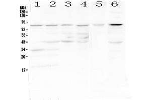 Western blot analysis of CD19 using anti-CD19 antibody .