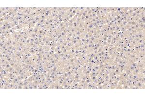 Detection of APOF in Rat Liver Tissue using Polyclonal Antibody to Apolipoprotein F (APOF) (Apolipoprotein F antibody  (AA 155-308))