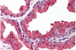 Human Prostate: Formalin-Fixed, Paraffin-Embedded (FFPE) (DYRK1A antibody  (AA 22-71))