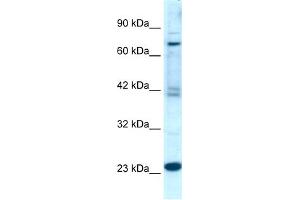 WB Suggested Anti-RGS10 Antibody Titration:  0. (RGS10 antibody  (Middle Region))