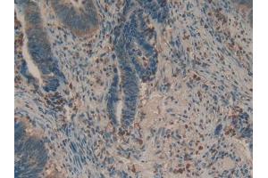 Used in DAB staining on fromalin fixed paraffin- embedded liver tissue (Biglycan antibody  (AA 243-369))