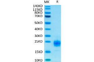 Biotinylated Human TIGIT on Tris-Bis PAGE under reduced condition. (TIGIT Protein (His-Avi Tag,Biotin))