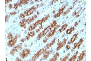 Image no. 2 for anti-Tumor Necrosis Factor alpha (TNF alpha) antibody (ABIN6171941) (TNF alpha antibody)