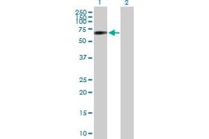 Western Blot analysis of SNPH expression in transfected 293T cell line by SNPH MaxPab polyclonal antibody. (Syntaphilin antibody  (AA 1-494))
