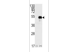 Western blot analysis of TP53(arrow) using rabbit polyclonal p53 Antibdoy (T55) (ABIN390200 and ABIN2840687). (p53 antibody  (AA 33-62))