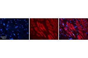 Rabbit Anti-RAD23B Antibody Catalog Number: ARP56505_P050 Formalin Fixed Paraffin Embedded Tissue: Human heart Tissue Observed Staining: Cytoplasmic Primary Antibody Concentration: 1:100 Other Working Concentrations: N/A Secondary Antibody: Donkey anti-Rabbit-Cy3 Secondary Antibody Concentration: 1:200 Magnification: 20X Exposure Time: 0. (RAD23B antibody  (Middle Region))