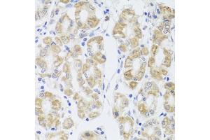 Immunohistochemistry of paraffin-embedded human stomach using MIP antibody (ABIN3016917, ABIN3016918, ABIN3016919 and ABIN6219879) at dilution of 1:100 (40x lens). (Mip (AA 50-150) antibody)