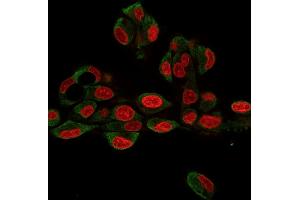 Immunofluorescence Analysis of HePG2 cells labeling GRP94 with GRP94 Rat Monoclonal Antibody (9G10. (GRP94 antibody)