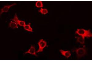 ABIN6268688 staining HeLa by IF/ICC. (IL-4 antibody  (Internal Region))