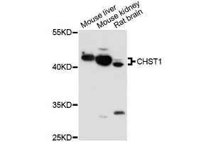 Western blot analysis of extracts of various cell lines, using CHST1 antibody (ABIN6292877) at 1:1000 dilution. (CHST1 antibody)