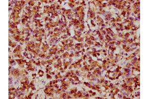 IHC image of ABIN7127557 diluted at 1:61. (Recombinant HSP27 antibody)