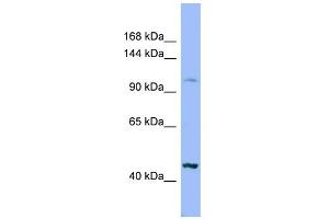 WB Suggested Anti-XYLT2 Antibody Titration:  0. (XYLT2 antibody  (Middle Region))
