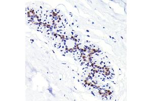 Immunohistochemistry of paraffin-embedded human breast using CDKN1B/p27KIP1 Rabbit mAb (ABIN7266602) at dilution of 1:100 (40x lens).