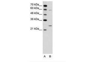Image no. 1 for anti-Guanidinoacetate N-Methyltransferase (GAMT) (N-Term) antibody (ABIN6736619) (GAMT antibody  (N-Term))