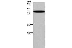 Western Blot analysis of Hela cell using DDX19B Polyclonal Antibody at dilution of 1:400 (DDX19B antibody)