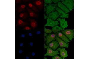 ABIN6257185 and ABIN6274308 staining Hela cells by IF/ICC. (Foxk1 antibody  (Internal Region))
