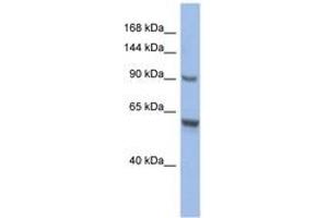 Image no. 1 for anti-CDKN1A Interacting Zinc Finger Protein 1 (CIZ1) (AA 719-768) antibody (ABIN6742457) (CIZ1 antibody  (AA 719-768))