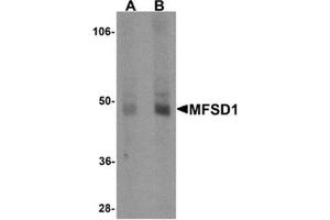 Western blot analysis of MFSD1 in human lung tissue lysate with MFSD1 antibody at (A) 1 and (B) 2 μg/ml. (MFSD1 antibody  (Center))