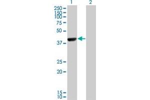 Western Blot analysis of CAMK1D expression in transfected 293T cell line by CAMK1D monoclonal antibody (M10), clone 3H8. (CAMK1D antibody  (AA 1-95))