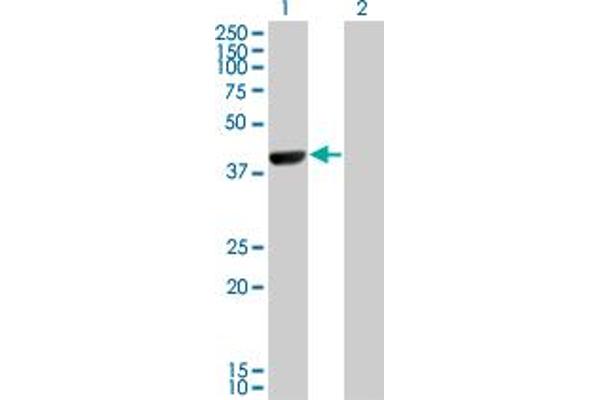 CAMK1D antibody  (AA 1-95)