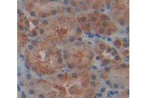 Figure. (SIRT5 antibody  (AA 48-244))