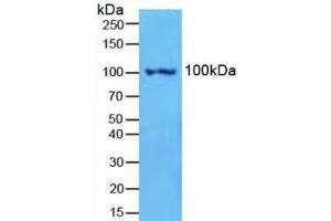 Figure. (Nuclear Factor kappa B2 (AA 38-343) antibody)