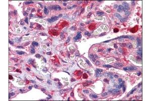 Human Placenta: Formalin-Fixed, Paraffin-Embedded (FFPE) (GDI2 antibody)