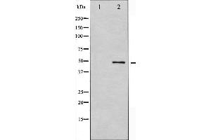 Western blot analysis of GSK3 alpha expression in ovarycancer whole cell lysates,The lane on the left is treated with the antigen-specific peptide. (GSK3 alpha antibody  (N-Term))