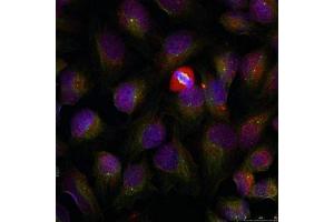 Immunofluorescence staining of methanol-fixed HeLa cells using NF-kappa,B p105/p50 (phospho-Ser337) antibody. (NFKB1 antibody  (pSer337))