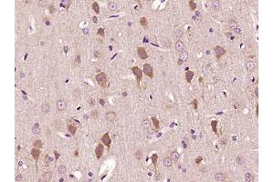 IMMT antibody  (AA 241-340)