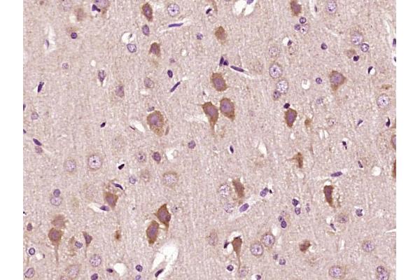 IMMT antibody  (AA 241-340)
