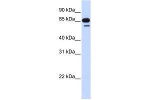 R3HDM2 antibody used at 1 ug/ml to detect target protein. (R3HDM2 antibody  (Middle Region))