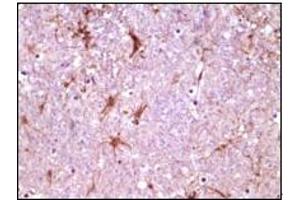 Immunohistochemistry (IHC) image for anti-Calcium and Integrin-Binding Protein 1 (CIB1) (truncated) antibody (ABIN2464036) (CIB1 antibody  (truncated))