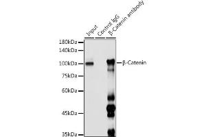 Immunoprecipitation analysis of 300 μg extracts of 293T cells using 3 μg β-Catenin antibody (ABIN6134299, ABIN6139205, ABIN6139208 and ABIN6215244). (CTNNB1 antibody  (AA 1-100))