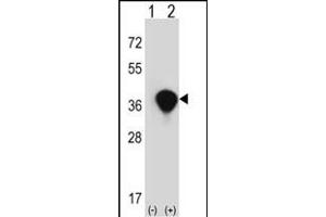 Western blot analysis of TALDO1 (arrow) using rabbit polyclonal TALDO1 Antibody (Center) (ABIN390629 and ABIN2840933). (TALDO1 antibody  (AA 186-215))