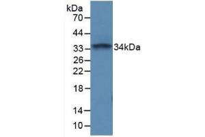 Detection of Recombinant PTPRC, Mouse using Polyclonal Antibody to Protein Tyrosine Phosphatase Receptor Type C (CD45) (CD45 antibody  (AA 371-556))