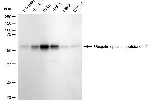 anti-Ubiquitin Specific Peptidase 22 (USP22) antibody