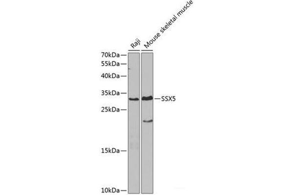 SSX5 antibody