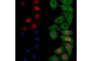 ABIN6256764 and ABIN6267179 staining heat-shock treated Hela cells by IF/ICC.