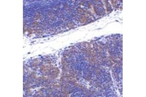 Immunohistochemistry of TNFRSF14 in mouse thymus tissue with this product at 1 μg/ml. (HVEM antibody  (N-Term))