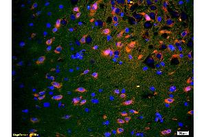 Formalin-fixed and paraffin embedded rat brain labeled with Anti-SPR Polyclonal Antibody, Unconjugated (ABIN724385) 1:200 followed by conjugation to the secondary antibody and DAB staining (TACR1 antibody  (AA 2-50))