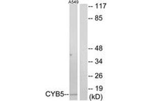 Western blot analysis of extracts from A549 cells, using CYB5 Antibody. (Cytochrome b5 (CYTB5) (AA 61-110) antibody)
