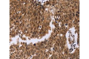 Immunohistochemistry (IHC) image for anti-Excision Repair Cross-Complementing Rodent Repair Deficiency, Complementation Group 6-Like (ERCC6L) antibody (ABIN2423388) (ERCC6L antibody)