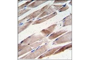 Image no. 1 for anti-Desmin (DES) antibody (ABIN357901) (Desmin antibody)