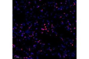 Immunofluorescence of paraffin embedded mouse lung using hmgn1 (ABIN7074222) at dilution of 1: 1000 (250x lens) (HMGN1 antibody)